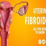 Fibroids Treatment Medicine Without Surgery in Accra, Ghana