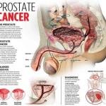 Prostate Cancer Treatment Medicine and Supplements in Accra, Ghana