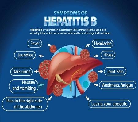 Hepatitis B