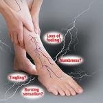 Neuropathy Pain Treatment Medicine in Accra, Ghana