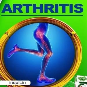 Rheumatoid Arthritis and Jaundice Treatment Medicine in Accra, Ghana